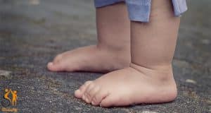 صافی کف پا در کودکان